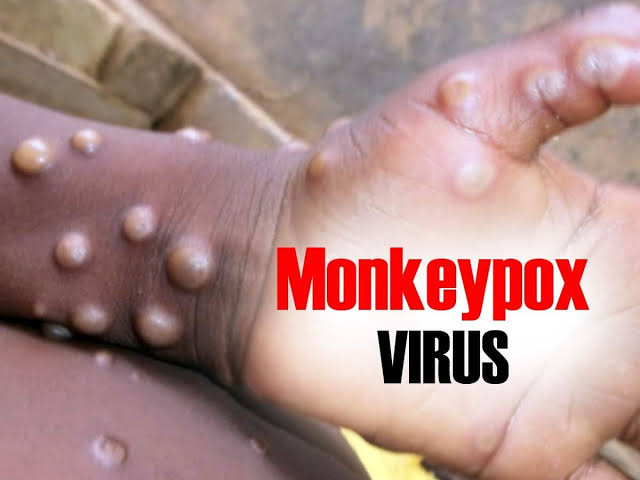 Monkeypox