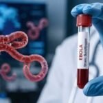 Ebola