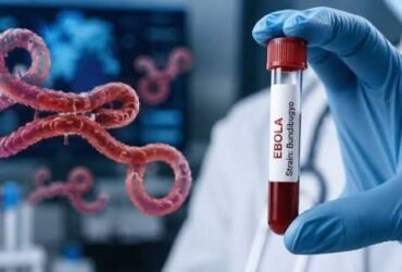 Ebola