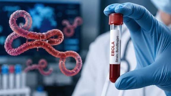 Ebola